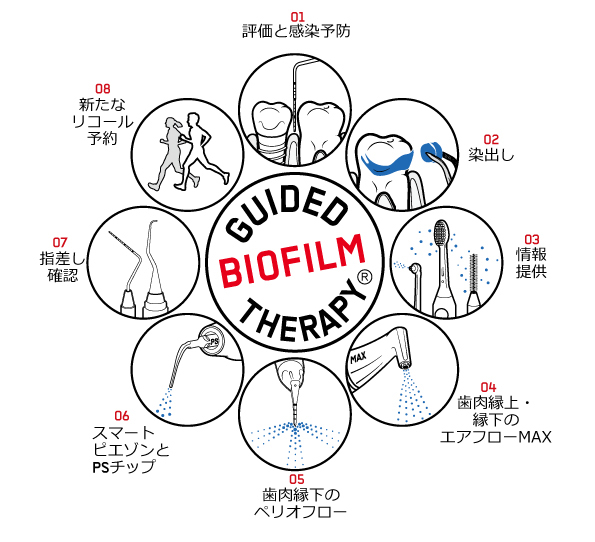 GBTによるクリーニング法